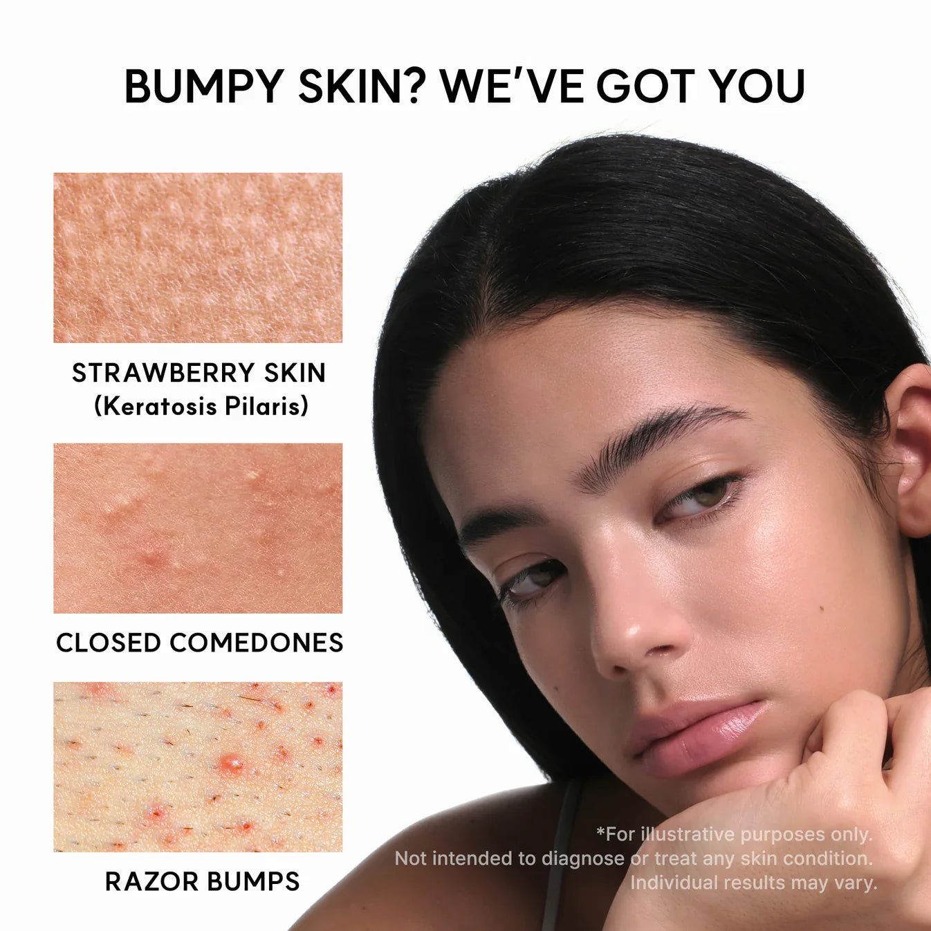 Lioraroot Clear Skin Duo – Glycolic Acid & Vitamin C Skincare Set