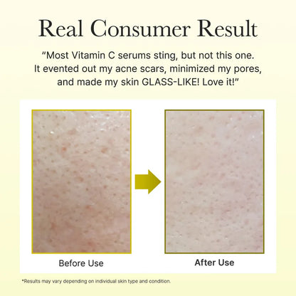 Lioraroot Clear Skin Duo – Glycolic Acid & Vitamin C Skincare Set