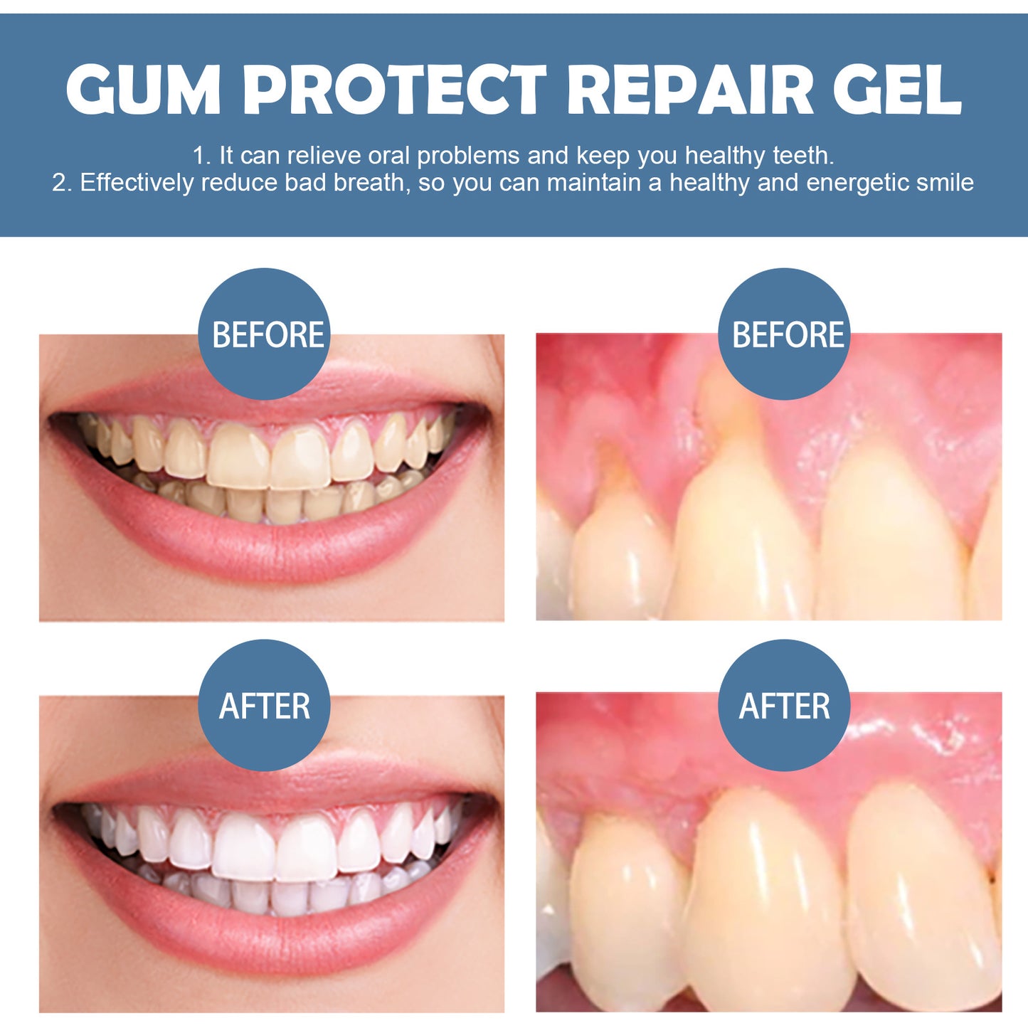 Daily Gum Comfort Gel | Fresh Breath & Everyday Oral Care