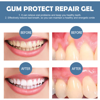 Daily Gum Comfort Gel | Fresh Breath & Everyday Oral Care