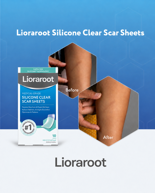 Lioraroot Silicone Clear Scar Sheets – 10 Pack