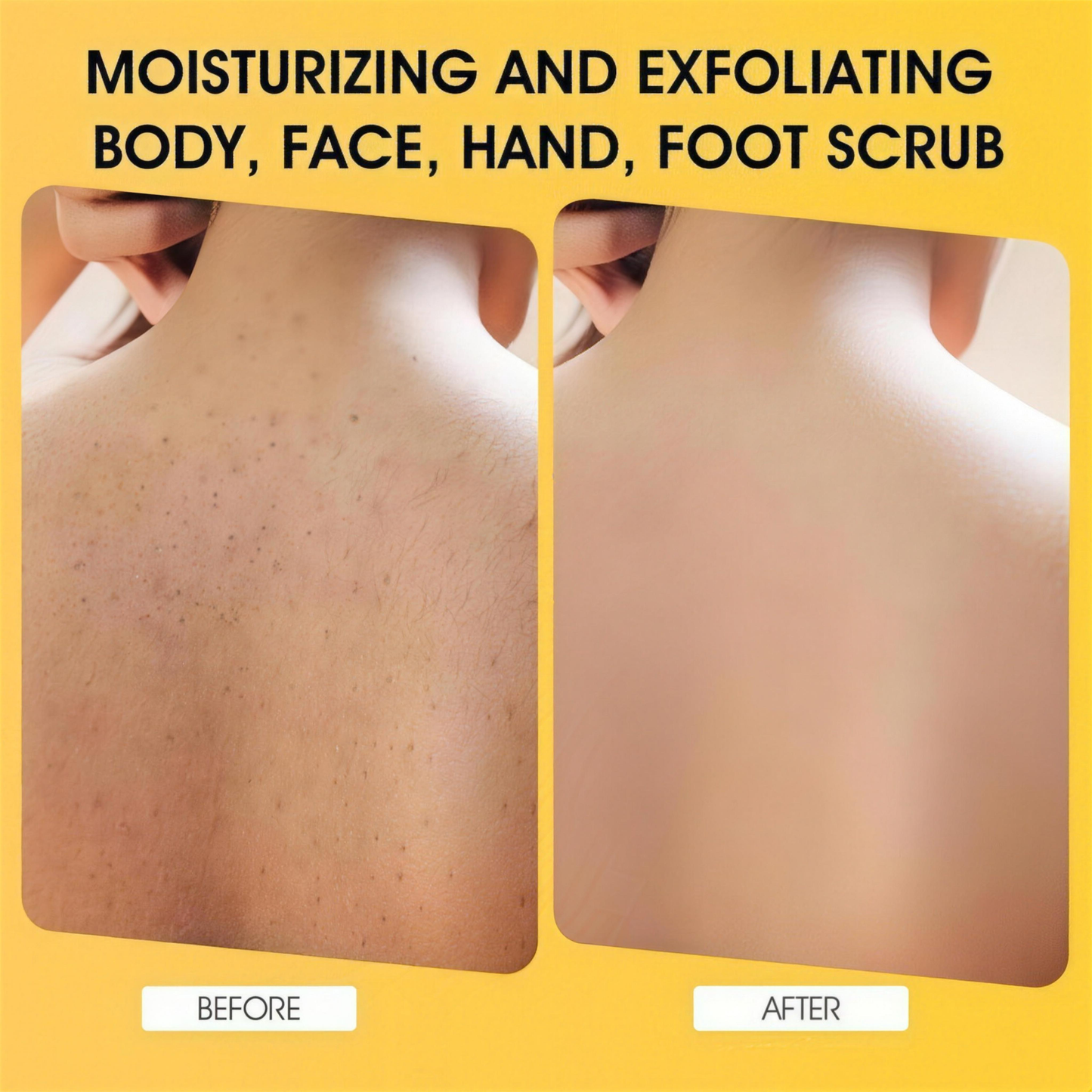 Turmeric Body Scrub 2-Pack, Gentle Exfoliating & Brightening for Dark Spots & Rough Skin, Hydrating Glow Formula, 2×280g
